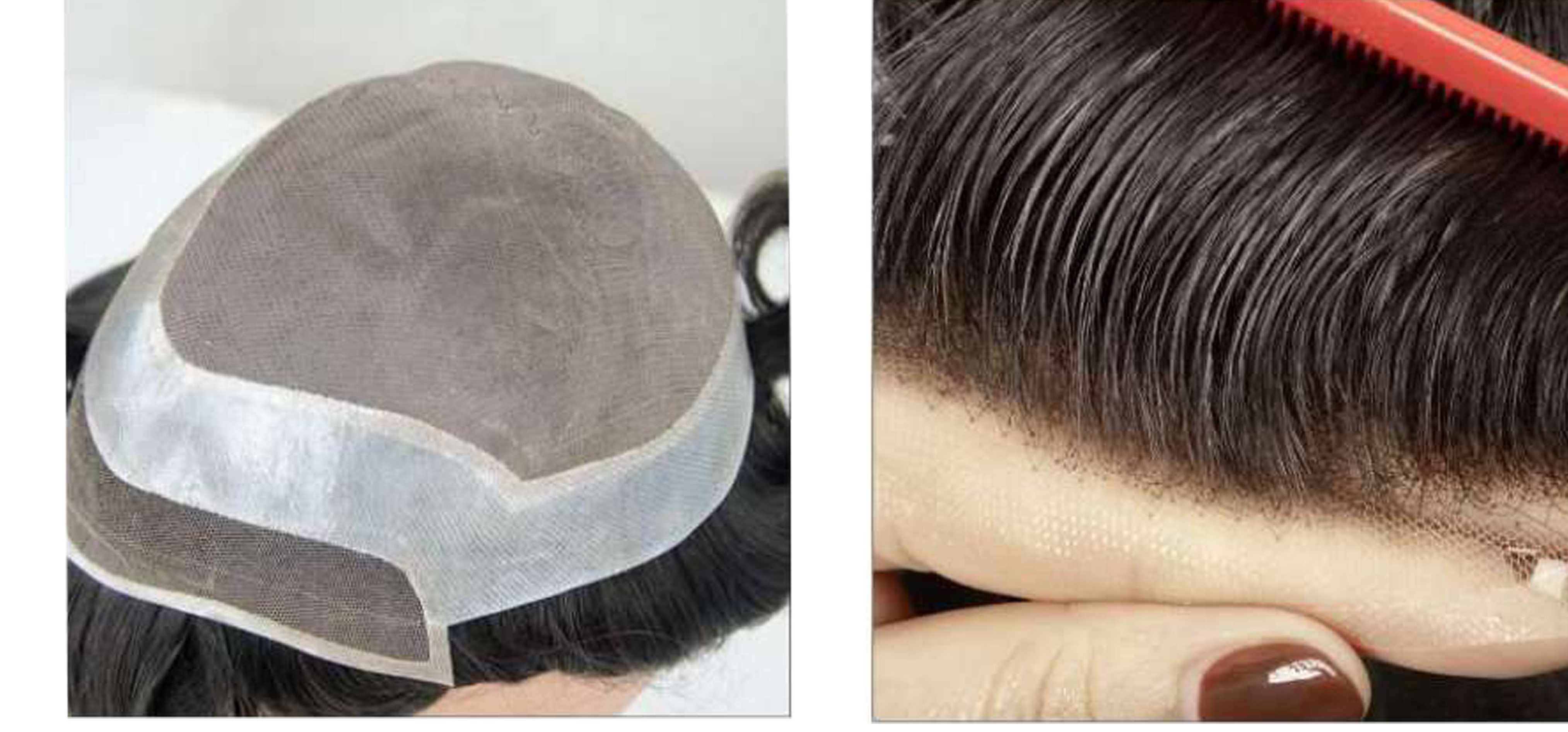 کلاه گیس مردانه طبیعی پروتز مو کف سر مردانه آنکارایی (کد:8057)